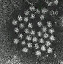 ノロウイルス（小型球形ウイルス、ＳＲＳＶ）