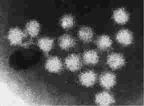 小型球形ウイルスの写真