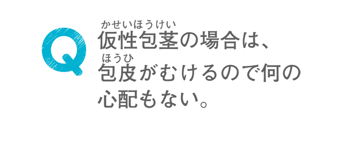 仮性包茎の場合は、包皮がむけるので何の心配もない。